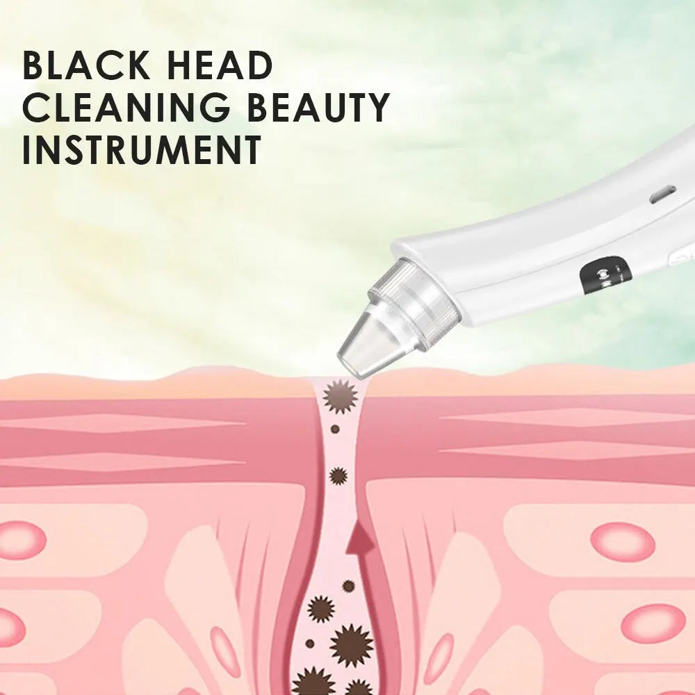 GlowLift Pro Facial Vacuum Cleanser